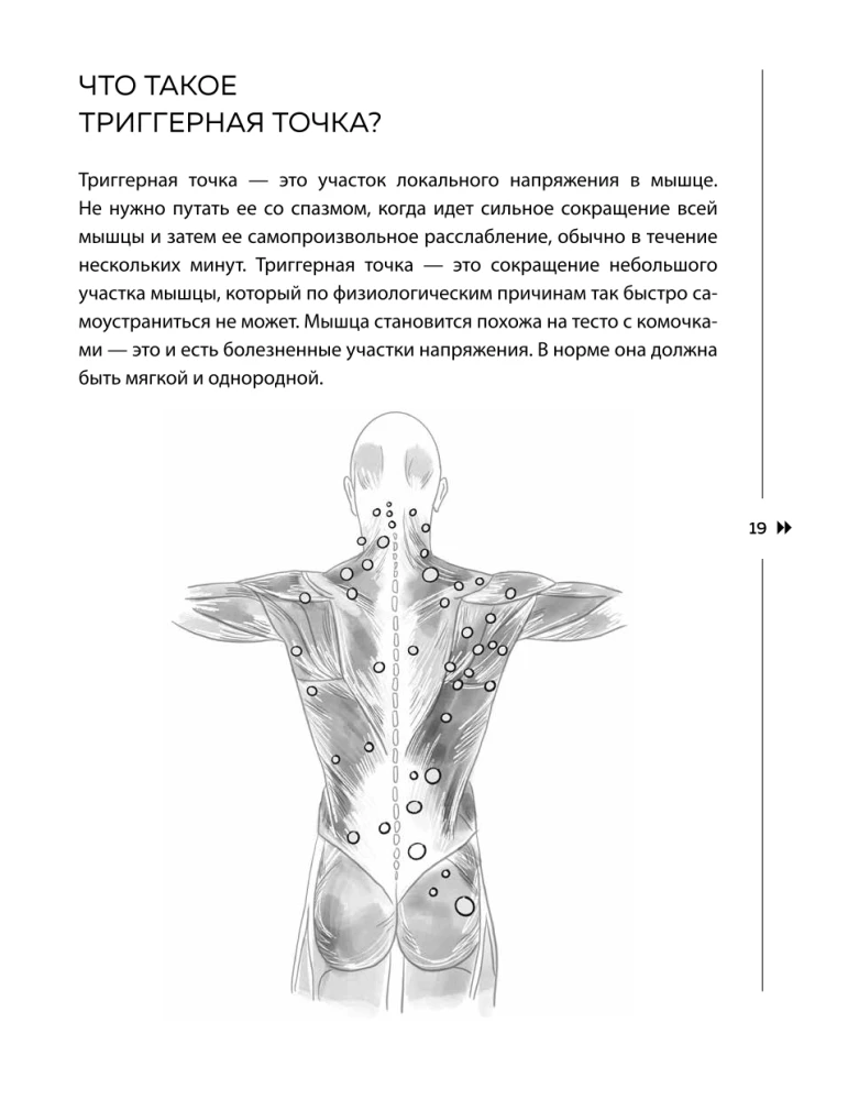 Atbrīvojies no trigerpunktiem. Gatavas vingrojumu programmas sāpju novēršanai mugurkaulā, locītavās un muskuļos.
